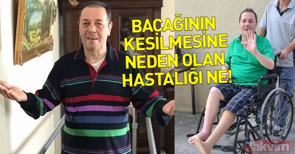 Yalçın Menteş'in bacağının kesilmesine neden olan hastalığı ne? İşte son durumu - 1