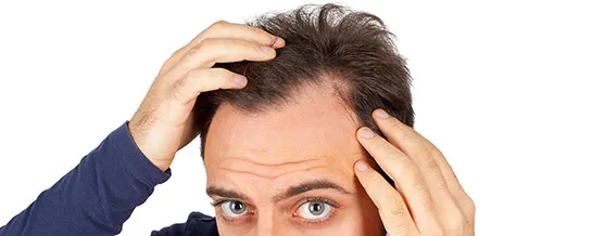 Saç dökülmesine ne iyi gelir? İşte evde doğal tedavi yöntemleri!-2