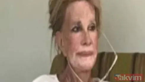 Pakize Suda öldü mü? Son haliyle üzmüştü... Demans hastalığıyla mücadele ediyordu kahreden haber sonrası ilk açıklama yeğenden geldi - 4