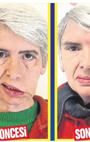 Altın nakliyle mucize yaşadı: 30 yıl sonra ilk kez iki gözü kapalı uyuyabildi!