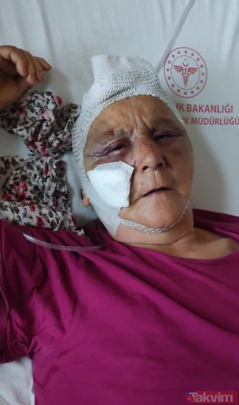 Kendisine para vermeyen anne ve babasını 2 saat boyunca baston koltuk değneği ve balta sapıyla dövdü - 10