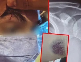 Ekrem’in trafik teröristleri! ‘Susun lan’ diye bağırıp…