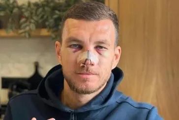 Edin Dzeko’dan sakatlık paylaşımı