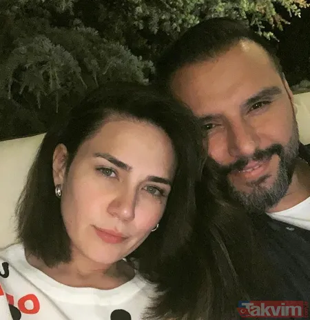 Alişan'ın eşi Buse Varol'un bu halini görenler şoke oldu 'buruşarak yaşlanmak istiyorum' demişti! Estetik güzeli... - 8