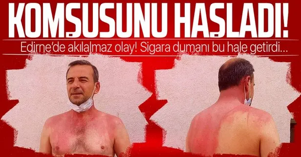 Komşusunu kaynar suyla haşladı!