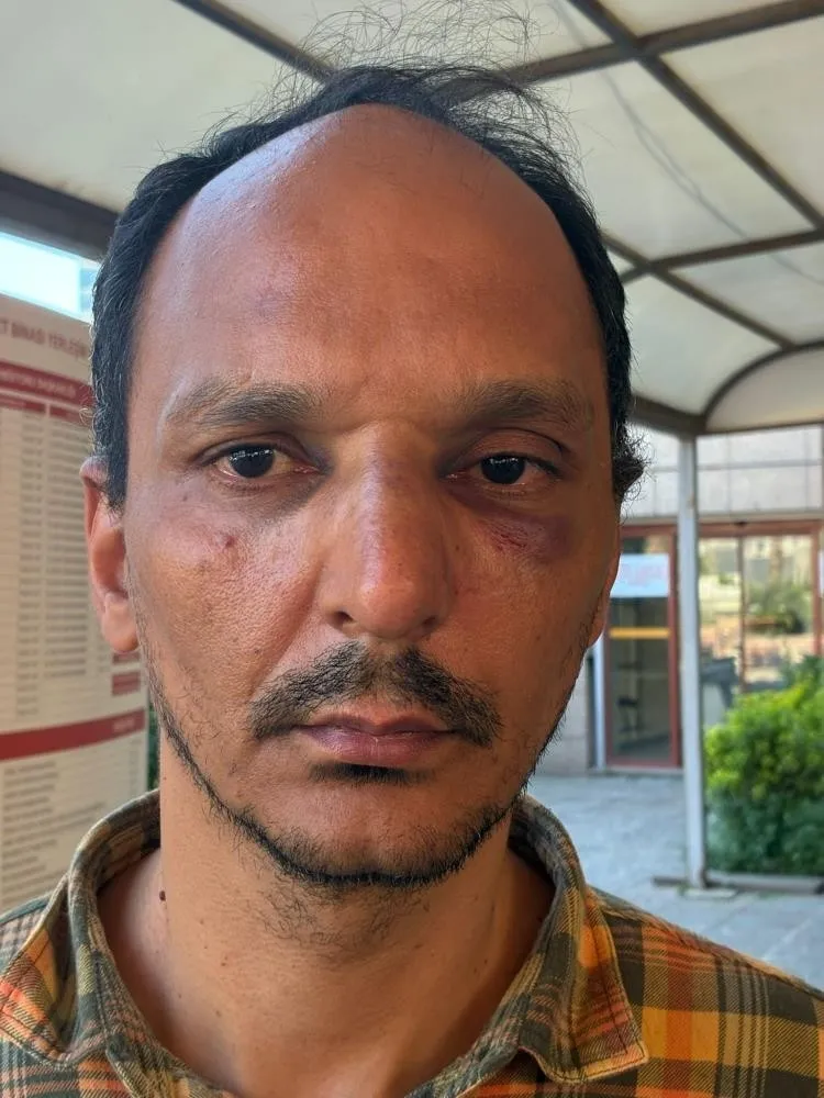 1779900014641.jpeg İzmir’deki provokasyonda TOMA'yı tekmeleyen Deniz Yolçu tutuklandı-2