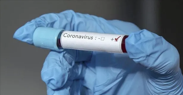 Dünya genelinde koronavirüs Kovid-19 nedeniyle ölenlerin sayısı 20 bini aştı