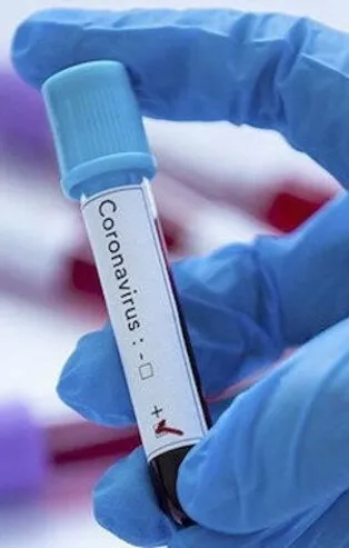 Çad'da ilk koronavirüs vakası görüldü