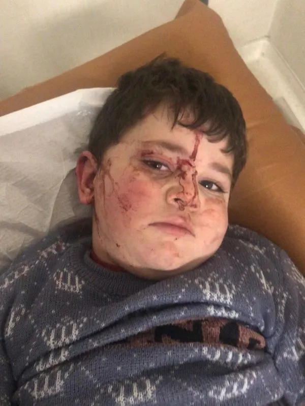 Ermenistan sivil halkı hedef alıyor dünya basını susuyor!-4