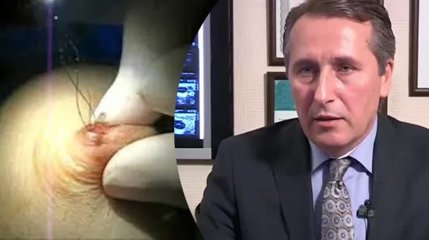 Türkiye'de tek olan tıbbi alet çalındı-3