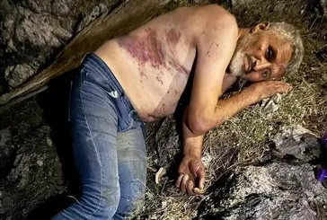 2 gün sonra o halde bulundu!