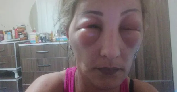 Yalova'da saçlarına boya yaptırmak isteyen kadın canından oluyordu-5