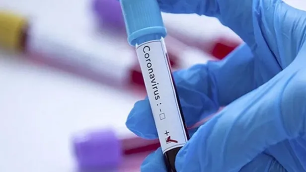 Brezilya Ligi'nde koronavirüs şoku | Vasco da Gama'da 16 oyuncunun testi pozitif çıktı-1