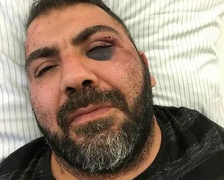 Almanyada ırkçı saldırı