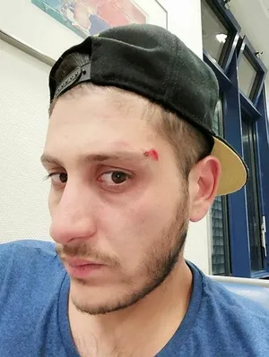 Almanya'da bir Türk'e polis köpeği ile şiddet-2