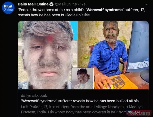 12 yıldır bir kere bile oturmadı sürekli ayakta! Duran Baba efsanesinin altından bakın ne çıktı! Neden oturmuyor diye merak edenler... - 7