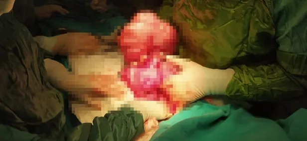 Tokat'ta akıllara durgunluk veren olay: Kilo aldığını sanıyordu gerçek bambaşka çıktı-4