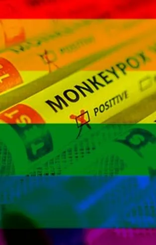 Avrupa'yı tehdit eden maymun çiçeğinin altından sapkın LGBT'liler çıktı! Erkekler arasındaki cinsel ilişki yoluyla bulaşıyor