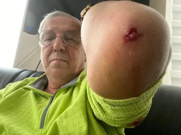 son-dakika-emniyet-duyurdu-yenicag-gazetesi-yazari-orhan-ugurogluna-saldiran-3-kisi-yakalandi-1610725523695.jpeg Son dakika: Ankara Emniyet Müdürlüğü duyurdu: Yeniçağ Gazetesi Yazarı Orhan Uğuroğlu'na saldıran 3 kişi yakalandı-3