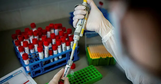 Son dakika: Bilim Kurulu Üyesi Prof. Dr. Ateş Kara'dan çarpıcı açıklama: "Yeni bulaşıcı hastalıklara hazır olalım"-7