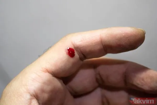 Orucu bozan şeyler nelerdir? İğne, ağda, epilasyon, serum, kan, regl, hastalık orucu bozar mı? ORUCU BOZAN HALLER VE DURUMLAR LİSTESİ 2024 - 17