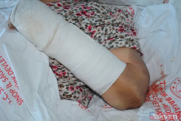 Kendisine para vermeyen anne ve babasını 2 saat boyunca baston koltuk değneği ve balta sapıyla dövdü - 4