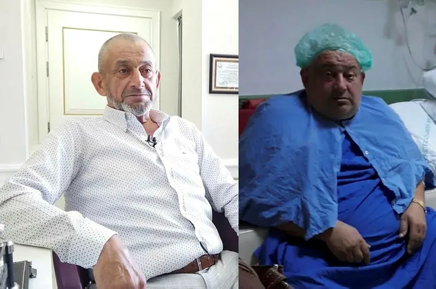 Ameliyatla 200 kilodan 84 kiloya düştü