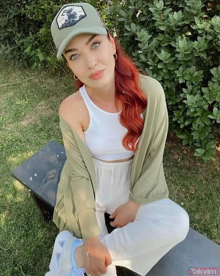 Kuzey Yıldızı İlk Aşk�ın Yıldız�ı Aslıhan Güner�in estetiksiz hali olay