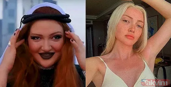 Danla Bilic sonunda bunu da yaptı, estetiğine estetik ekledi! Yüzünde yok yok - 5