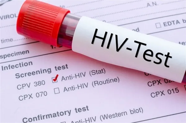1649053533683.jpg AIDS’e yol açan HIV virüsü şoku! Genç kadın bunalıma girdi! Doktora tazminat davası-3