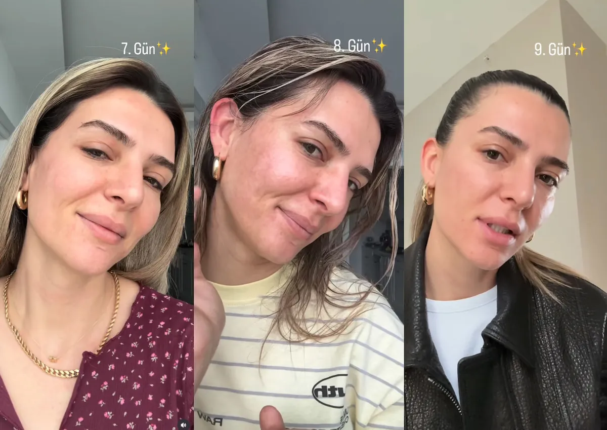 survivor-merve-aydinin-estetik-sonrasi-degisimi-gundem-oldu-1778839523403.jpg “15. gün” paylaşımı olay oldu! Survivor Merve Aydın’ın estetik sonrası değişimini görenler şaşkına döndü-4