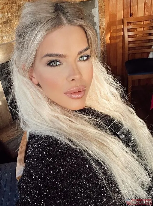 Sihirli Annem'in güzeller güzeli Tuğçe'sini gören tanıyamıyor! Damla Ersubaşı'nın estetik itirafı bomba: "Göğüslerimi..." - 5