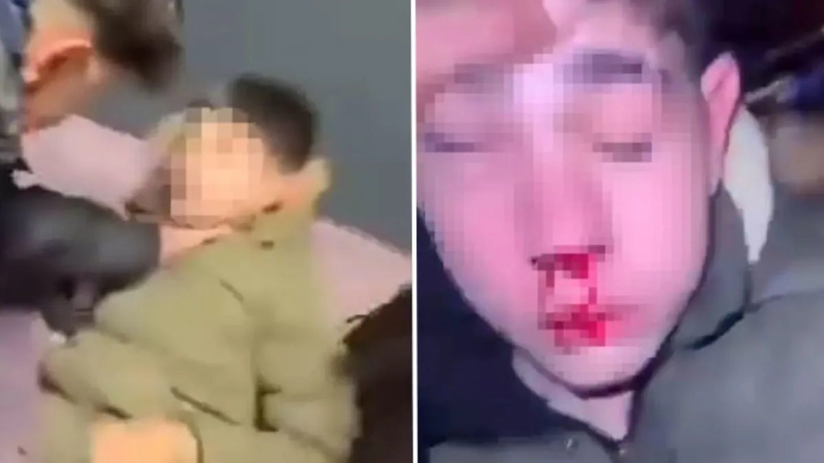 İşkenceli eğlencede 2 tutuklama