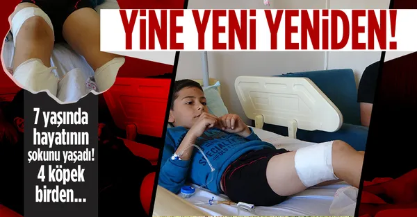 Bingöl'de 7 yaşındaki çocuk köpeklerin saldırısına uğradı-1