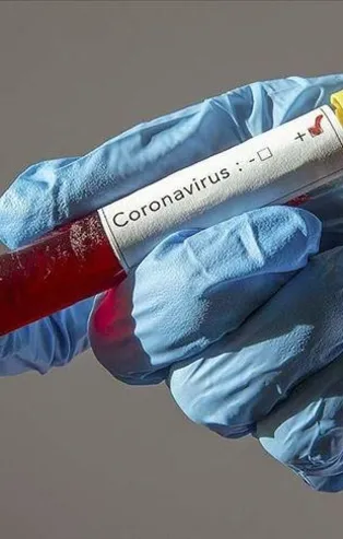 Son dakika: Rusya’da son 24 saatte 5 bin 966 yeni koronavirüs vakası