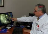 Sağlık Bakanlığından ‘uyuz’ açıklaması!