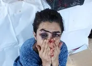 Kahreden sözler! Melek İpekin 112yle görüşmesi: Kocamı vurdum çabuk yetişin