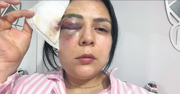 Kahramanmaraş’ta dehşet anları: Genç kız tanımadığı kişi tarafından sokak ortasında saldırıya uğradı!