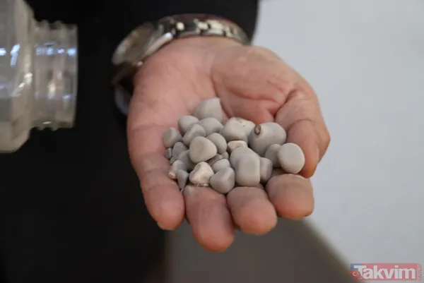 Üroloji doktorundan hayrete düşüren koleksiyon! Taşların kimisi 22 santim kimisi 650 gram - 7