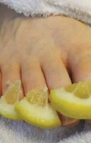 Ayak tırnak mantarı nasıl geçer? Ayak tırnak mantarına karşı ne iyi gelir?