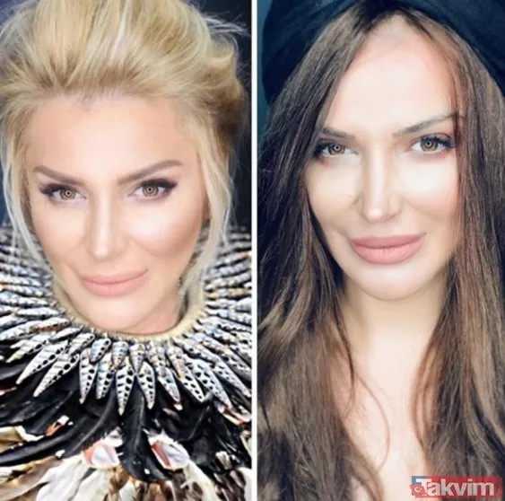 Hande Erçel’den Murat Dalkılıç’ın estetiksiz hali hakkında şok yorum