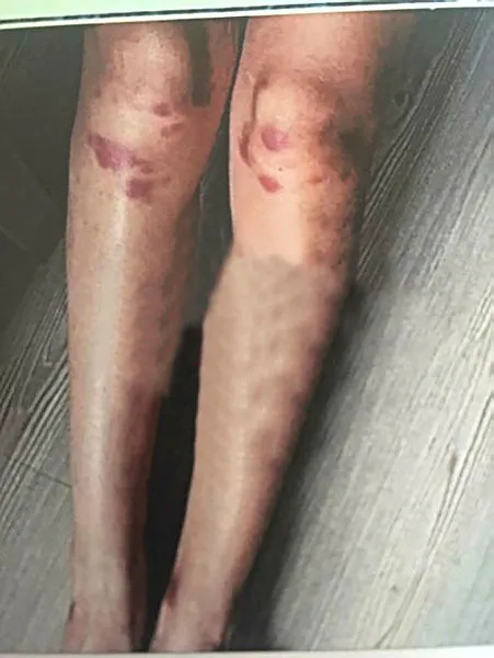 Ozan Güven - Deniz Bulutsuz davasında yeni gelişme: Bakanlık müdahil oldu!-2