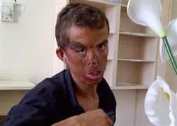 İşte tarihe geçecek ameliyat