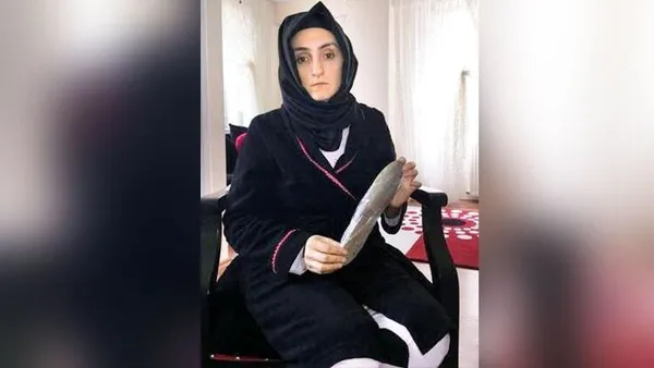 ameliyat-olan-kadinin-karninda-mala-unutuldu-1623390489785.jpg Ameliyat olan kadının karnında mala unutuldu-3