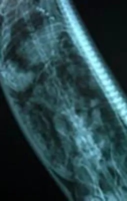 Akıl almaz röntgen görüntüleri!