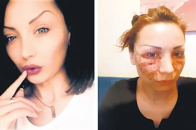 'Örümcek ağı' hayatını kabusa çevirdi: Tatyana Toleva 2 kuaför hakkında dava açıldı