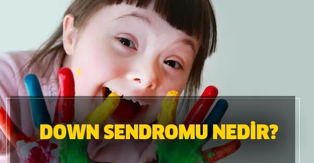 down sendromu belirtileri neler