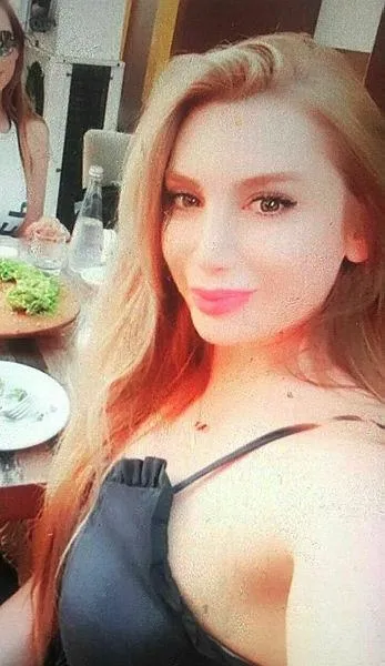 Son dakika: Kübra Boyraz'ı ölümüne neden olan estetikçilerin mağduru Orkide Acar: TIR çarpmış gibiyidim-1