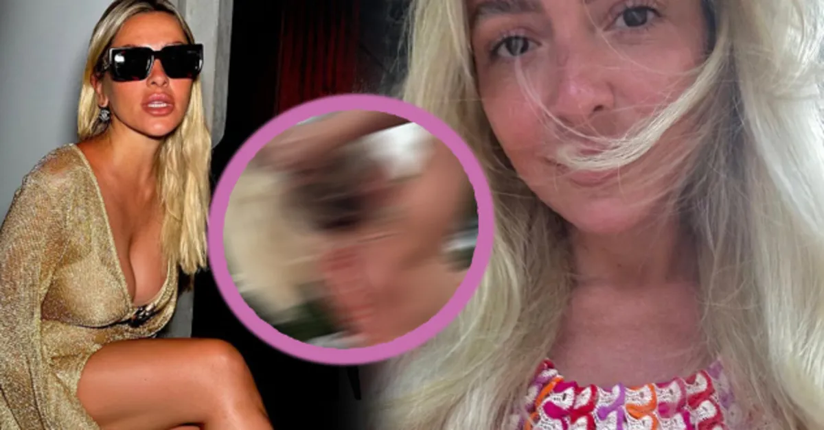 Yarı çıplak pozunun ardından şimdi de sütyensiz... Hadise cayır cayır yandı kavruldu o pozları görenler: Sana ne oldu böyle ıstakoz gibi olmuşsun