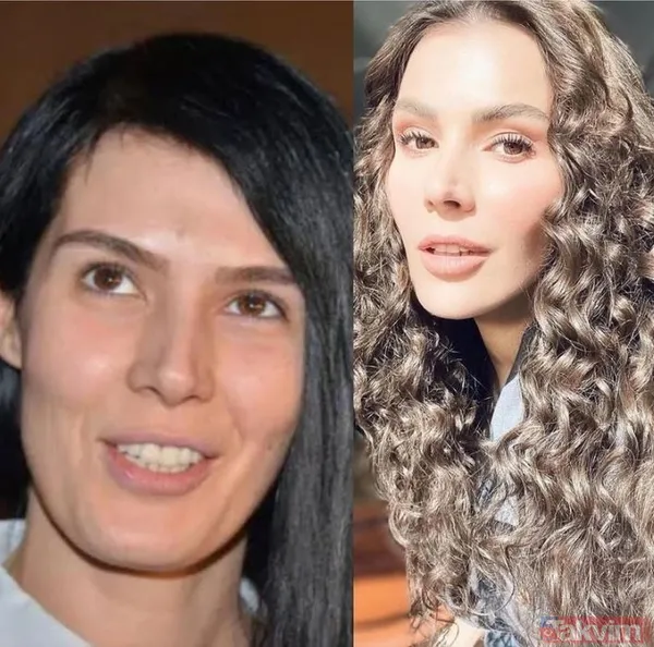 Ajda Pekkan'ın gençlik fotoğrafı hayrete düşürdü: Estetiksiz halini tanımak imkansız - 17